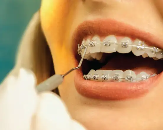 A woman getting her braces checked by a dentist.