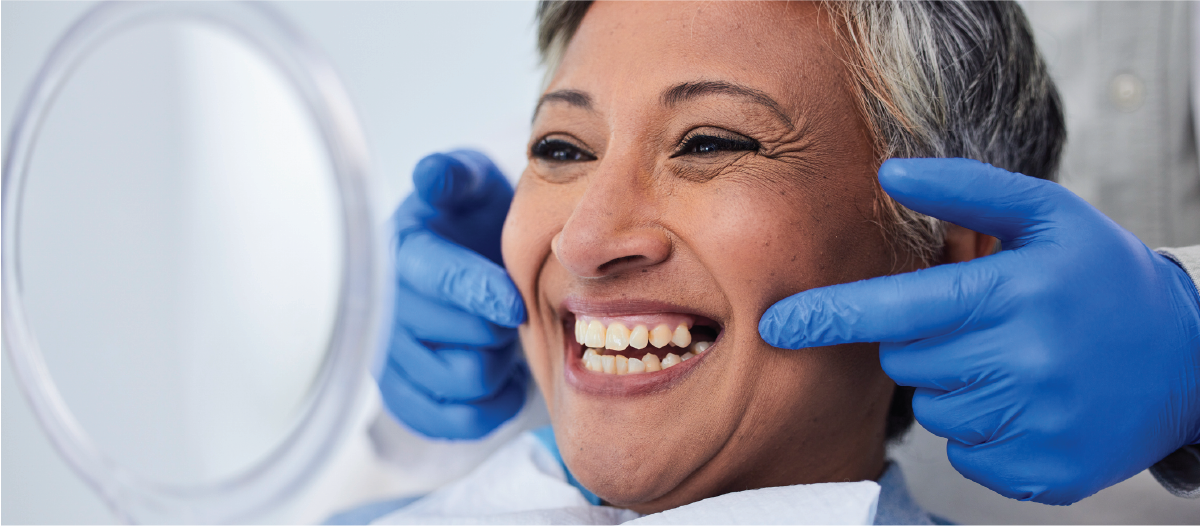 Middle age woman smiling after getting a gum graft surgery